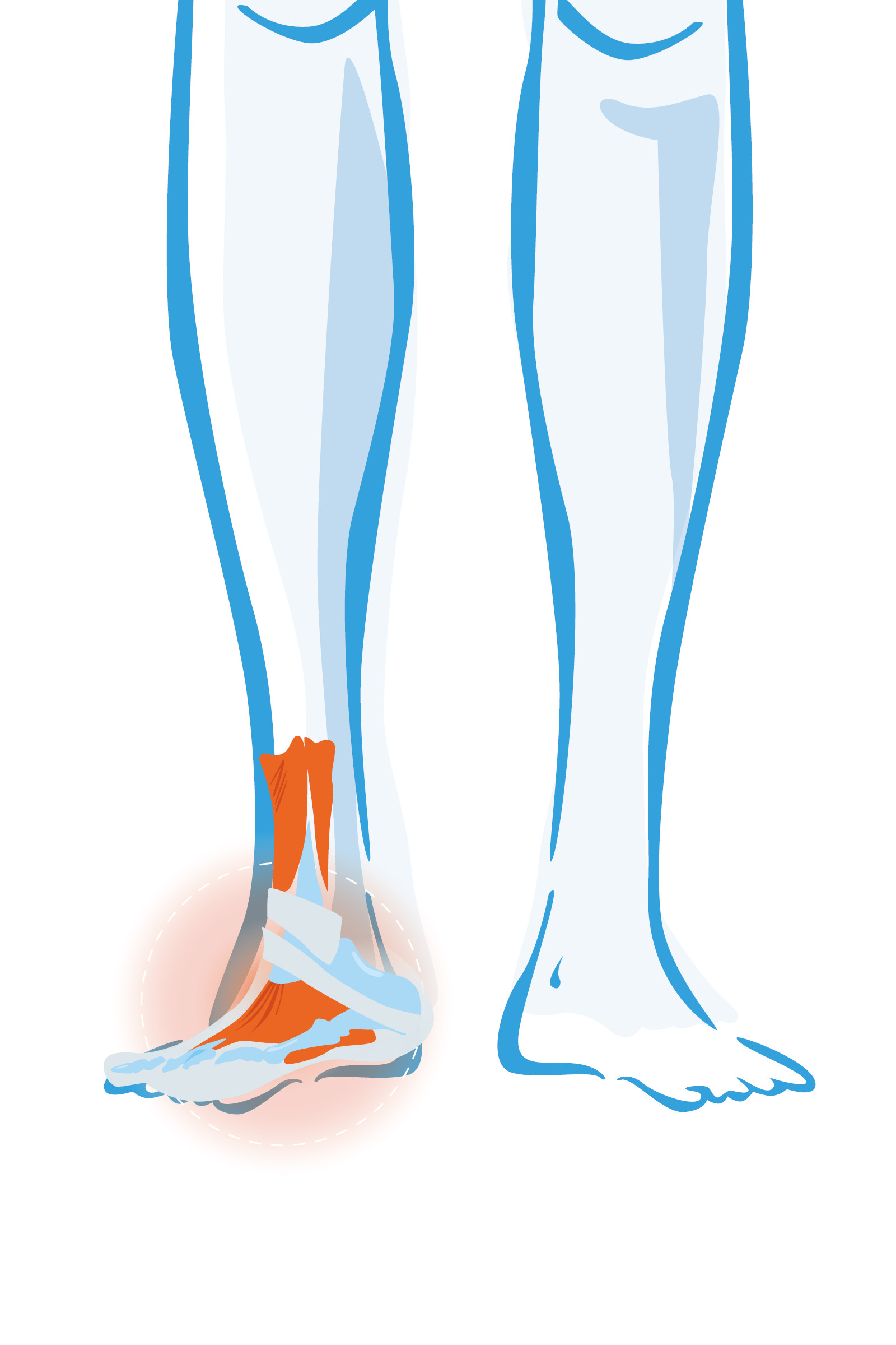 Enkel- en voetklachten